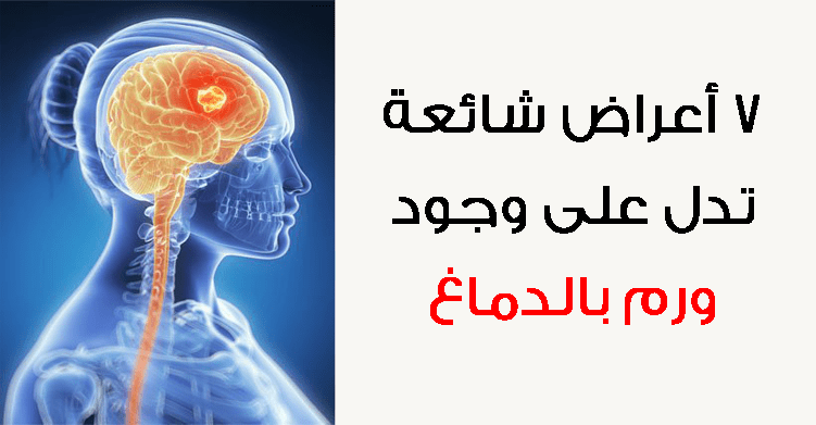 عوارض ورم الدماغ , اعراض واسباب اورام الدماغ والمخ