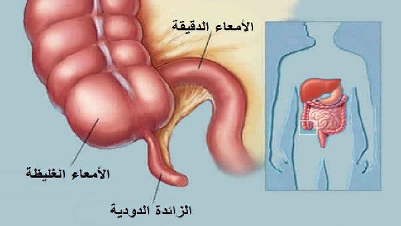 الزائدة الدودية , ماهى الزائده واعراض التهابها