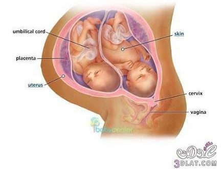 كيف اعرف اني حامل بتوام , علامات الحمل بتوام
