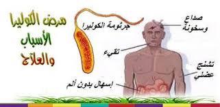 اعراض مرض الكوليرا , كيف اعرف اني مصاب بالكوليرا