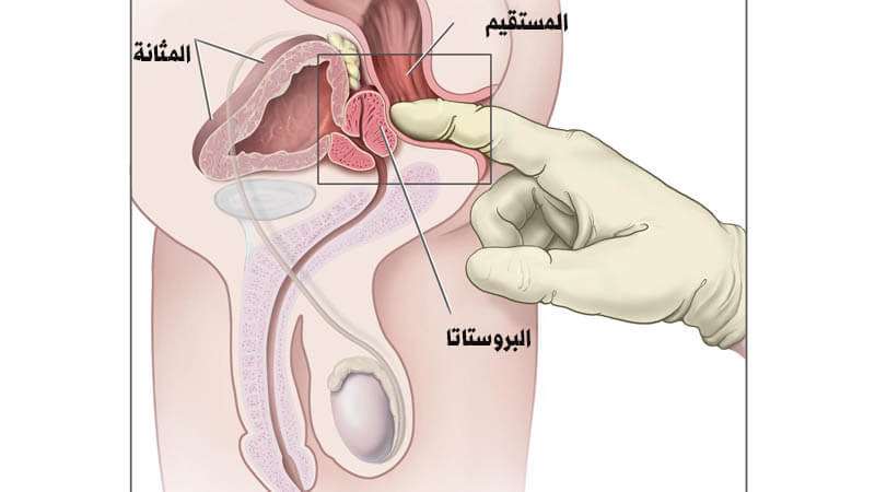 علاج البروستاتا , ماوسائل الشفاء من التهاب البروستاتا