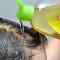 3944 3 علاج لتساقط الشعر - الحد من تساقط الشعر الولد المصلح