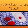 5949 3 الفرق بين دم الدورة ودم الحمل - كيفيه التمييز بين دم الحيض ودم الحمل حمراء